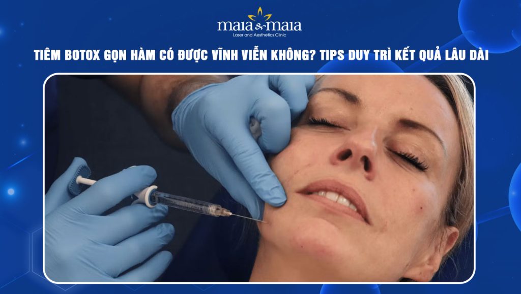 Tiêm botox gọn hàm có được vĩnh viễn không