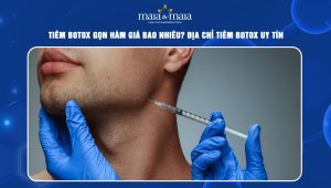 Tiêm botox gọn hàm giá bao nhiêu? Địa chỉ tiêm botox uy tín 56 Tiêm botox gọn hàm giá bao nhiêu
