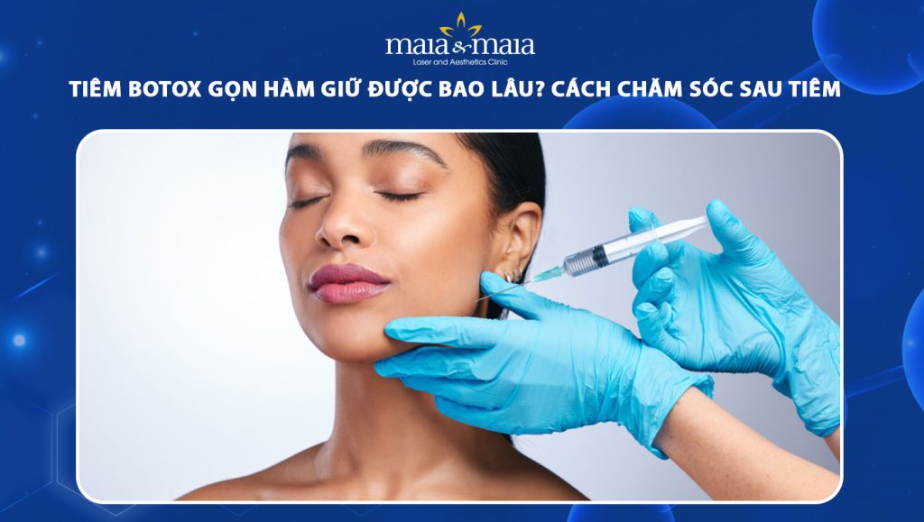 tiêm botox gọn hàm giữ được bao lâu