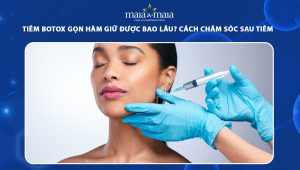 Tiêm botox gọn hàm giữ được bao lâu? Cách chăm sóc sau tiêm botox 82 tiêm botox gọn hàm giữ được bao lâu