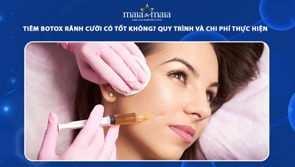 tiêm botox rãnh cười