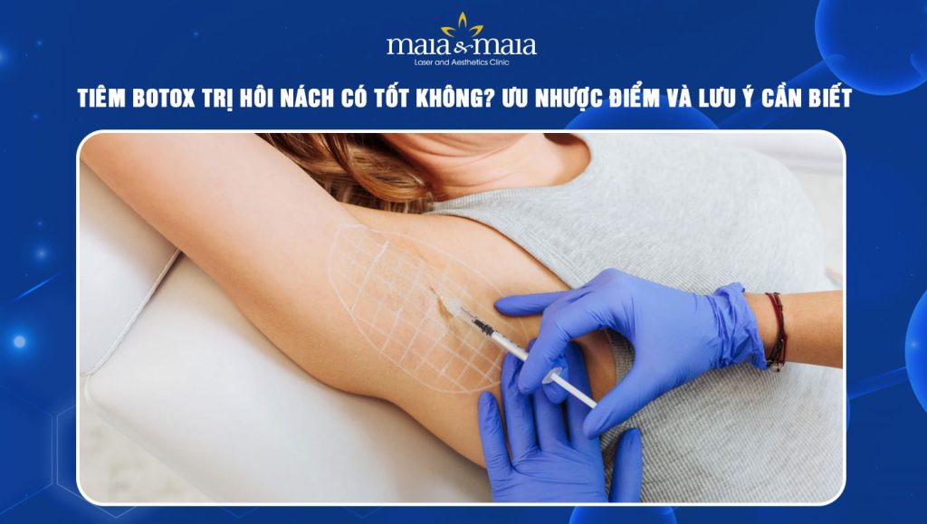 Tiêm botox trị hôi nách