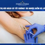 Tiêm botox trị hôi nách
