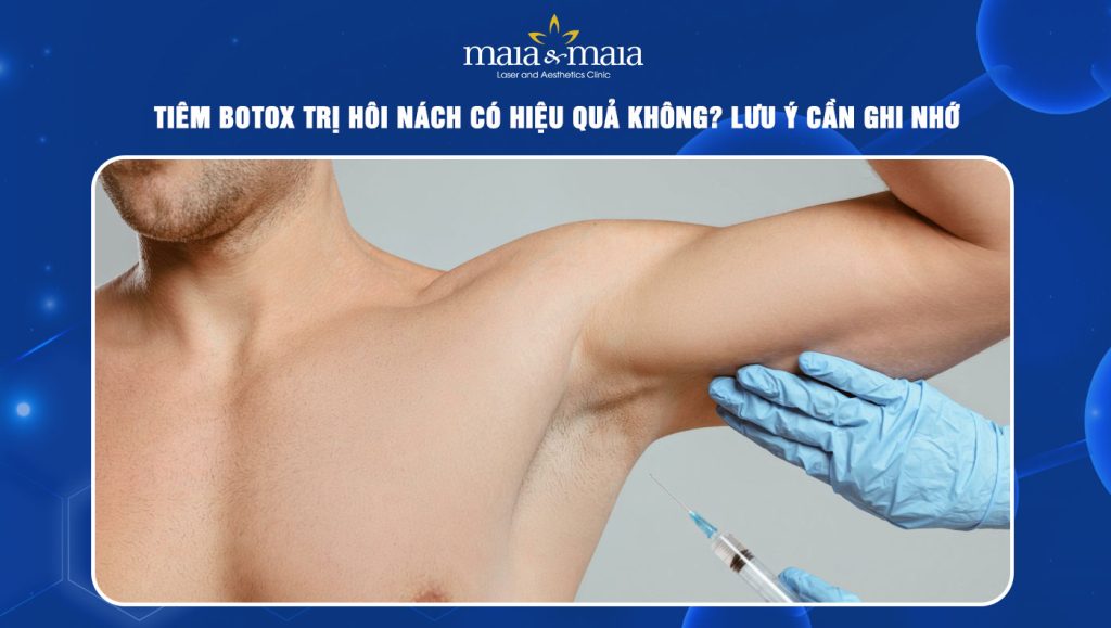 Tiêm botox trị hôi nách có hiệu quả không