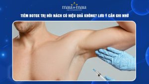Tiêm botox trị hôi nách có hiệu quả không? Lưu ý cần ghi nhớ 36 Tiêm botox trị hôi nách có hiệu quả không
