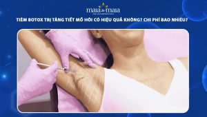 Tiêm botox trị tăng tiết mồ hôi có hiệu quả không? Chi phí bao nhiêu? 71 tiêm botox trị tăng tiết mồ hôi