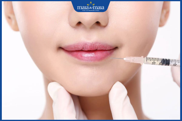 Tiêm botox khóe miệng có nên không? Lưu ý khi thực hiện 2 tiêm botox vào khóe miệng