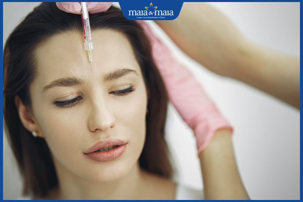 Tiêm botox xóa nhăn trán: Lợi ích, đối tượng phù hợp và địa chỉ thực hiện uy tín 2 tiêm botox vào trán
