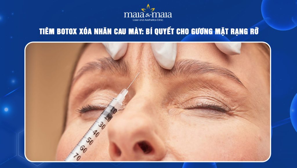 tiêm botox xóa nhăn cau mày