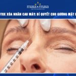 tiêm botox xóa nhăn cau mày