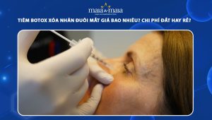 Tiêm botox xóa nhăn đuôi mắt giá bao nhiêu? Chi phí đắt hay rẻ? 95 tiêm botox xóa nhăn đuôi mắt giá bao nhiêu