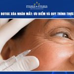 tiêm botox xoá nhăn mắt