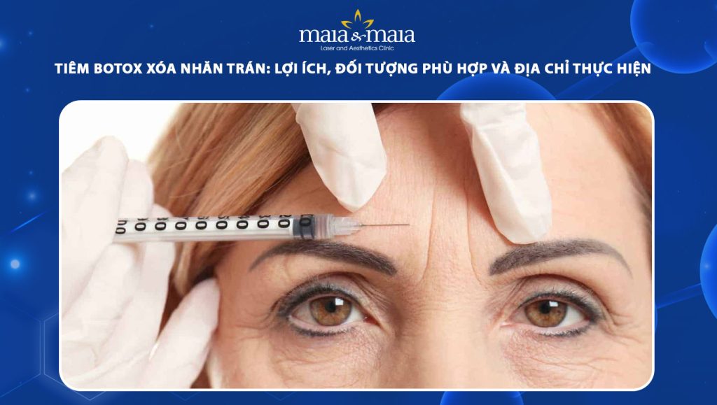 tiêm botox xóa nhăn trán