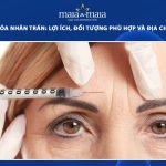 tiêm botox xóa nhăn trán