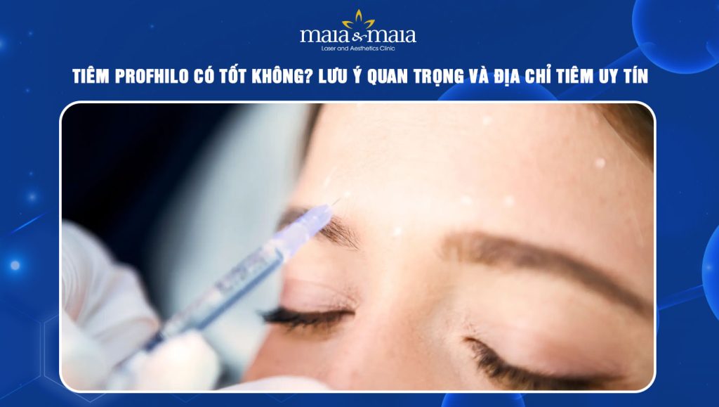 tiêm Profhilo có tốt không
