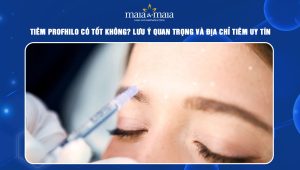 Tiêm Profhilo có tốt không? Lưu ý quan trọng và địa chỉ tiêm uy tín 55 tiêm Profhilo có tốt không