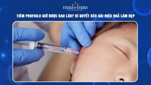 Tiêm profhilo giữ được bao lâu? Bí quyết kéo dài hiệu quả làm đẹp 44 tiêm profhilo giữ được bao lâu