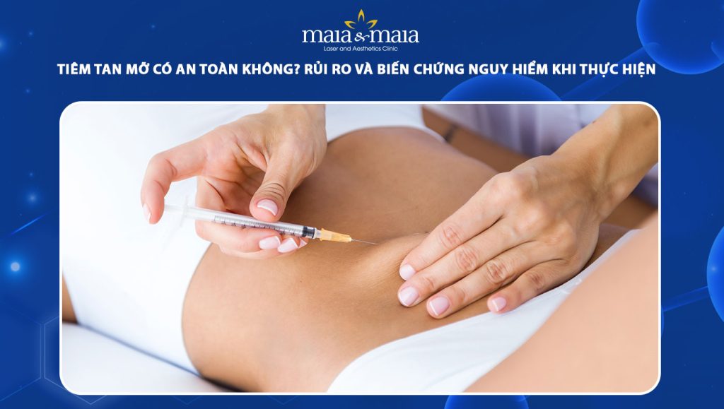 tiêm tan mỡ