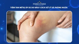 Tiêm tan mỡ bị áp xe do đâu? Cách xử lý và phòng ngừa  73 tiêm tan mỡ bị áp xe