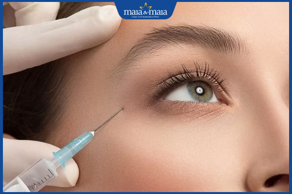 Gợi ý các cách xóa nếp nhăn vùng mắt an toàn và hiệu quả 5 tiêm xóa nhăn mắt