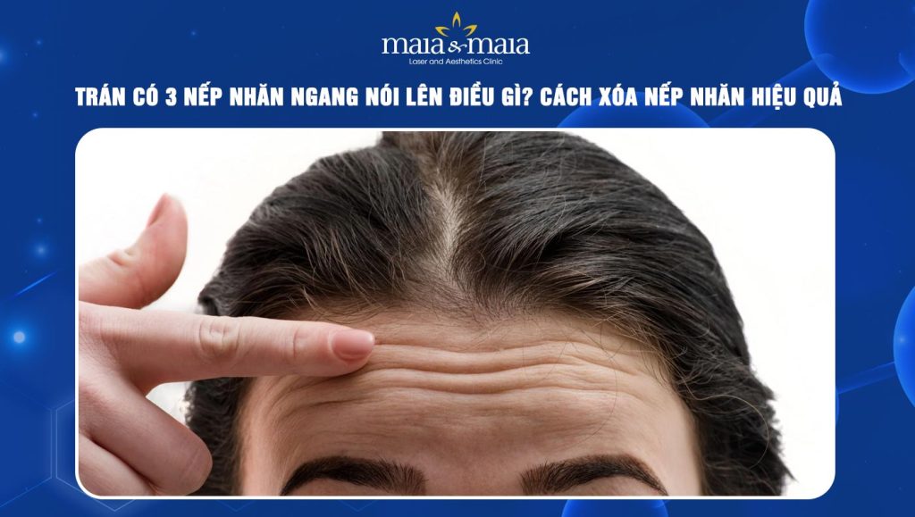 trán có 3 nếp nhăn ngang