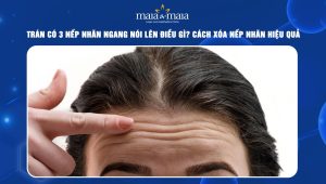 Trán có 3 nếp nhăn ngang nói lên điều gì? Cách xóa nếp nhăn hiệu quả 85 trán có 3 nếp nhăn ngang