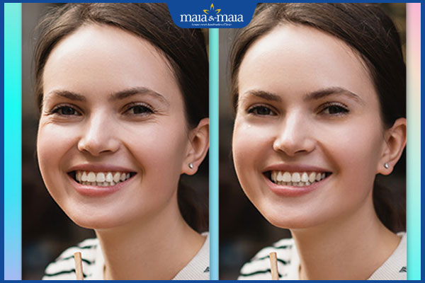 Tổng hợp top 5 app xóa nếp nhăn được ưa chuộng nhất hiện nay! 2 ứng dụng xóa nhăn