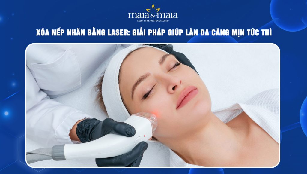 xóa nếp nhăn bằng laser