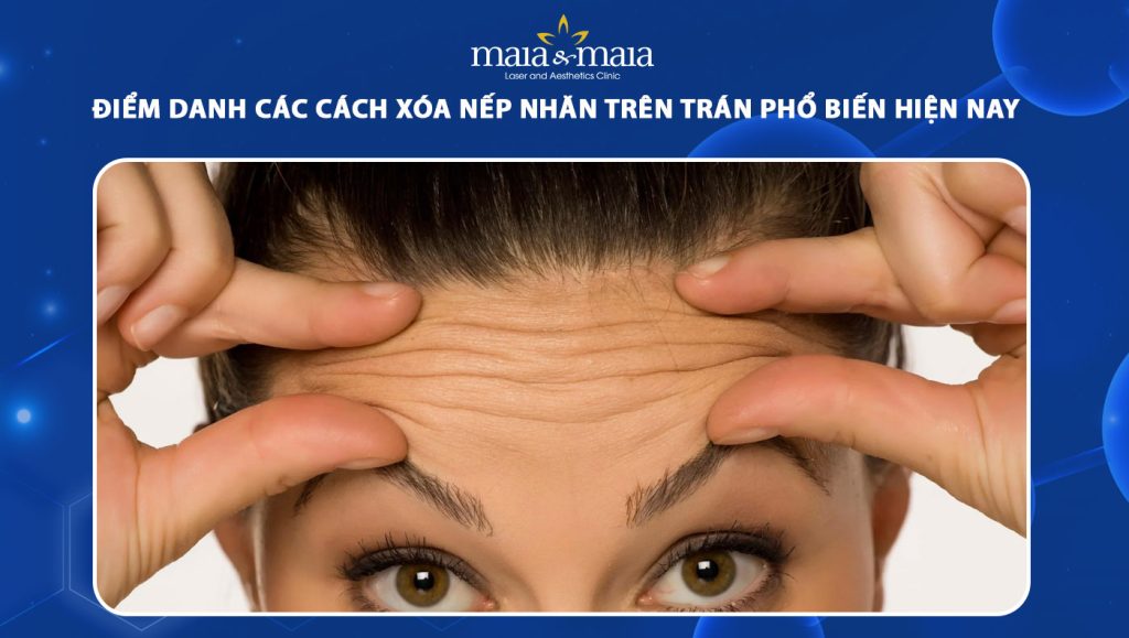 xóa nếp nhăn trên trán