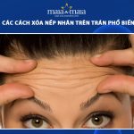xóa nếp nhăn trên trán
