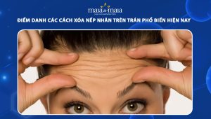 Điểm danh các cách xóa nếp nhăn trên trán phổ biến hiện nay 103 xóa nếp nhăn trên trán