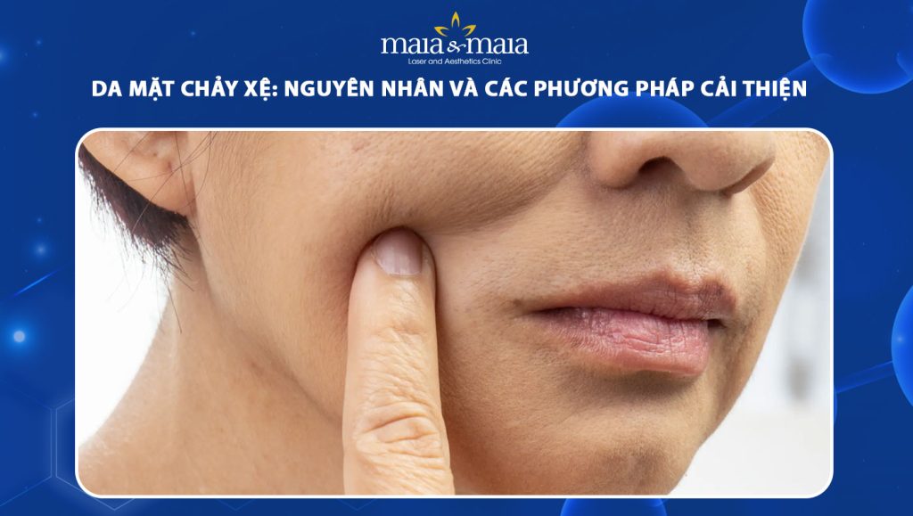da mặt chảy xệ