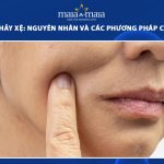 da mặt chảy xệ