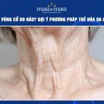 lão hóa da vùng cổ