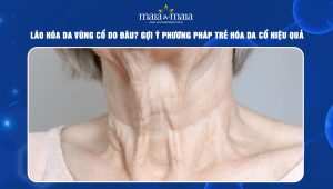 Lão hóa da vùng cổ do đâu? Gợi ý phương pháp trẻ hóa da cổ hiệu quả 38 lão hóa da vùng cổ