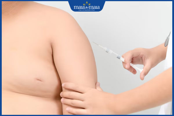 Tiêm tan mỡ bị vón cục nguyên nhân là gì? Cách xử lý ra sao? 2 thực hiện tiêm tan mỡ