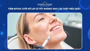 Tiêm botox cười hở lợi có tốt không? Bao lâu thấy hiệu quả? 34 tiêm botox cười hở lợi