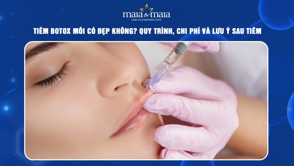 tiêm botox môi
