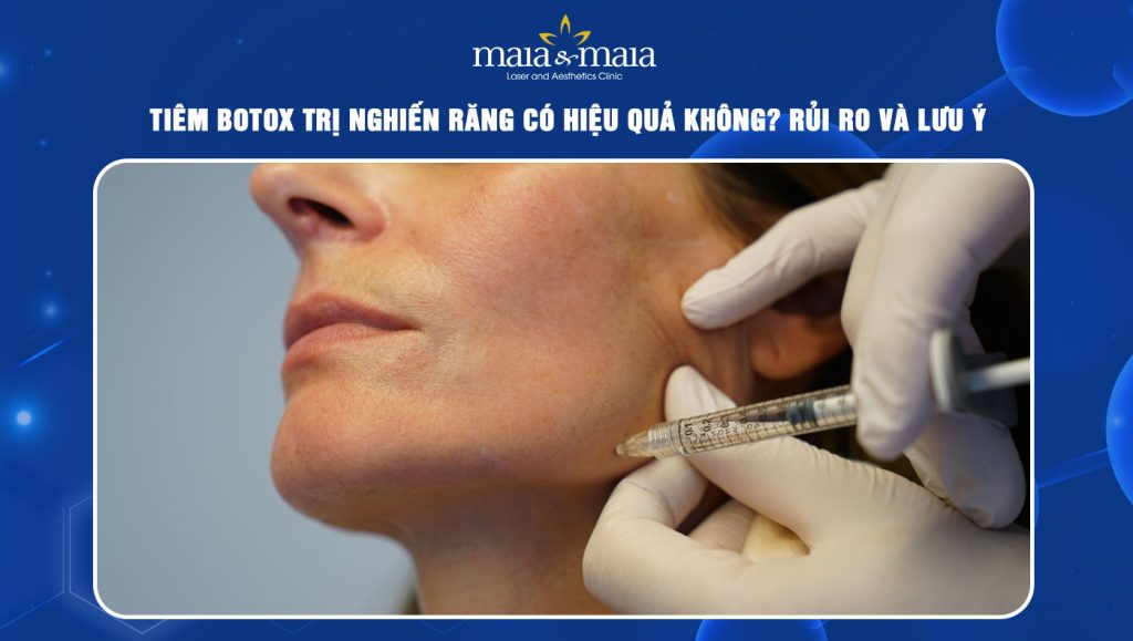 Tiêm botox trị nghiến răng