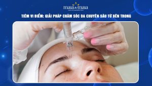 Tiêm vi điểm: Giải pháp chăm sóc da chuyên sâu từ bên trong 105 Tiêm vi điểm