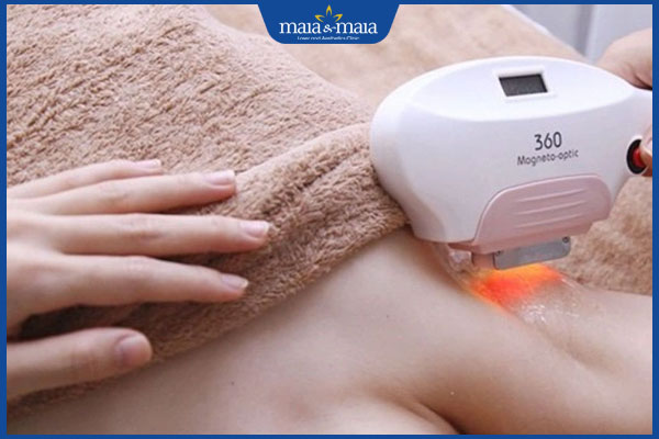 chiếu sáng sinh học vùng nách