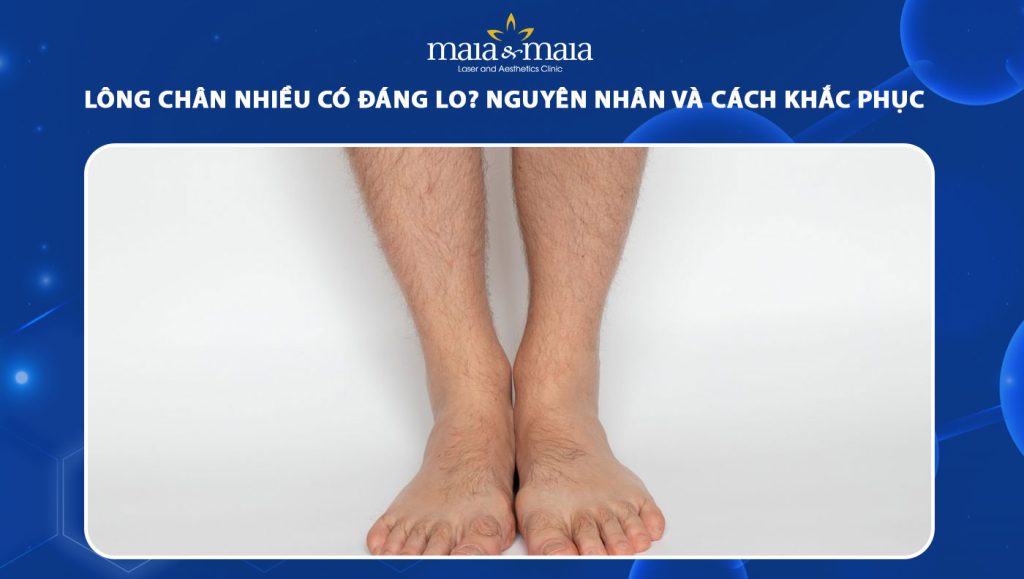 lông chân nhiều