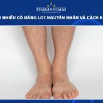 lông chân nhiều