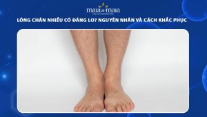 Lông chân nhiều có đáng lo? Nguyên nhân và cách khắc phục hiệu quả 75 lông chân nhiều