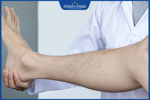 lông chân nhiều khám bác sĩ