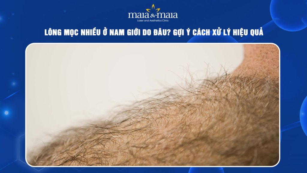 Lông mọc nhiều ở nam giới
