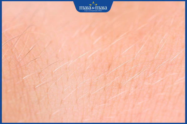 Triệt lông vĩnh viễn có mọc lại không? Cách duy trì hiệu quả lâu dài 2 lông thưa nhạt màu