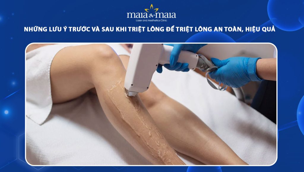 lưu ý trước và sau khi triệt lông