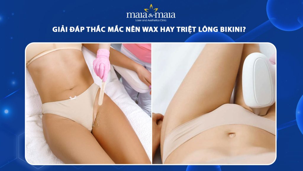 nên wax hay triệt lông bikini