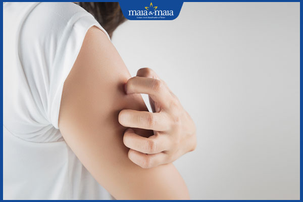 ngứa ngáy sau triệt lông